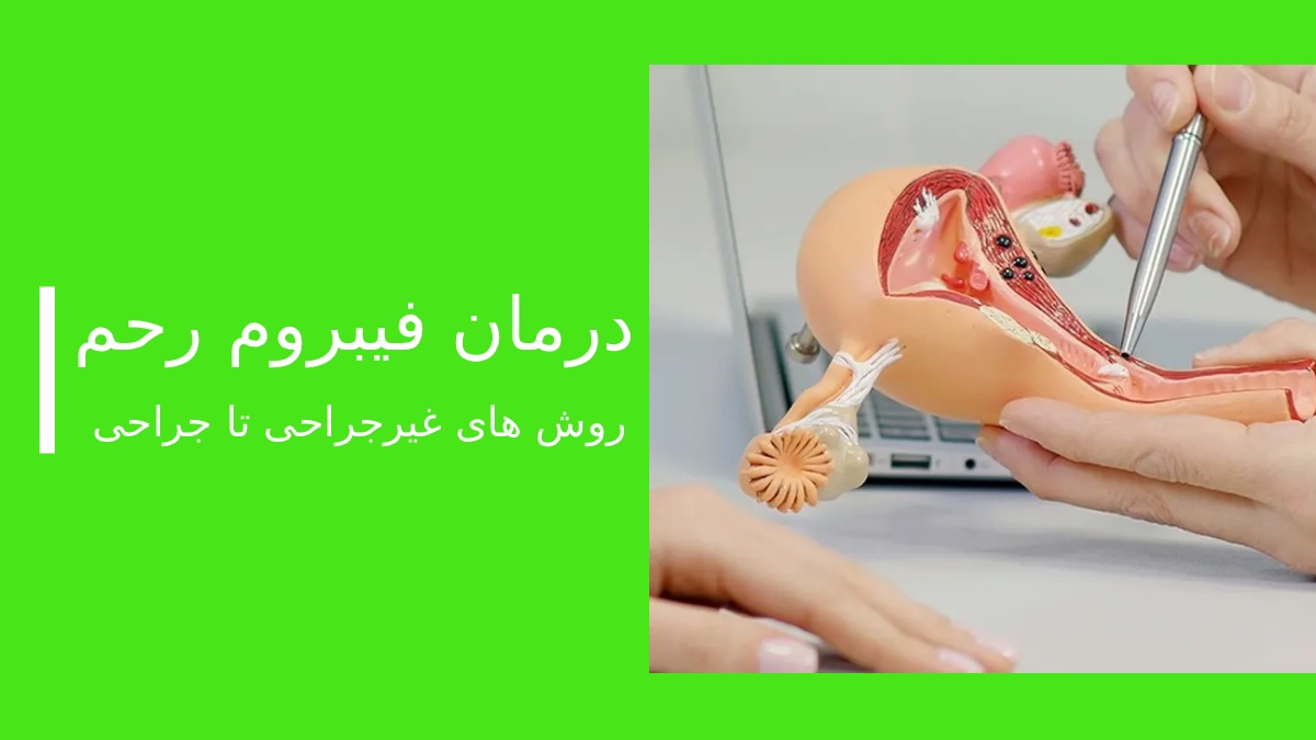 درمان فیبروم رحم هزینه جراحی در بهترین بیمارستان تهران